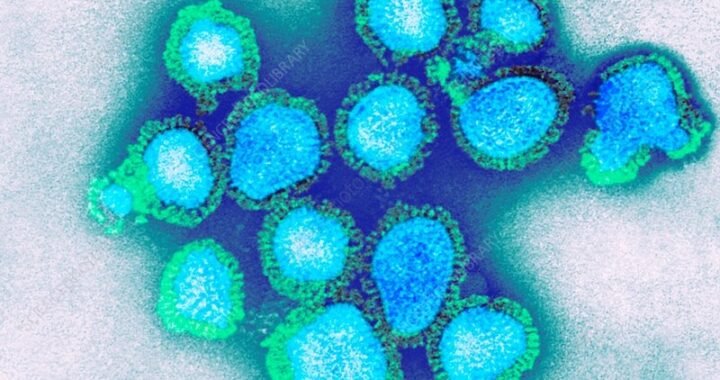 Confirman primer caso de influenza A(H3N2) en Chile: especialistas llaman a calma y prevención